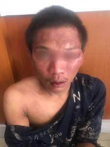 Seorang Pemuda Babak Belur Usai Mencuri Sepeda Motor